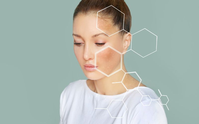 cải thiện làn da