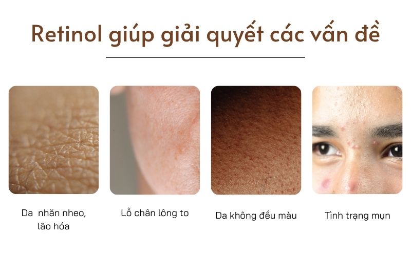 Công dụng của retinol

