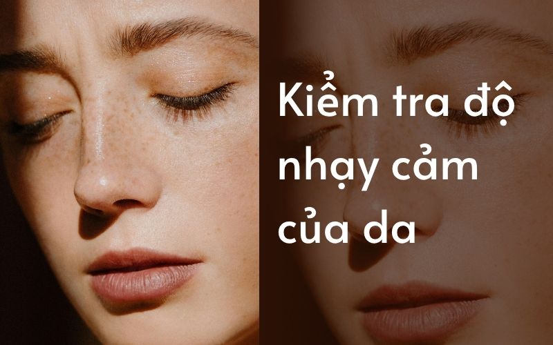 Kiểm tra độ nhạy cảm của da