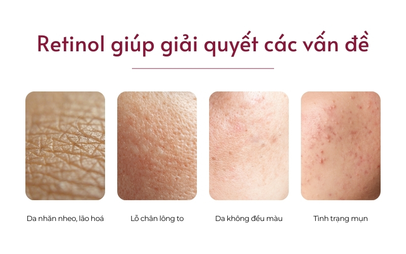 Retinol giúp tái tạo làn da