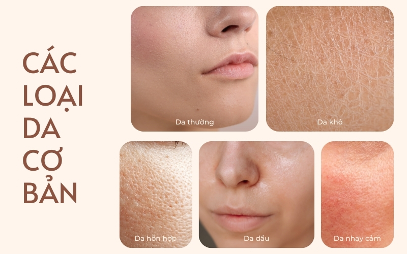 Các loại da cơ bản