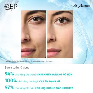 Aqua Intense Supreme Hyaluron Cream (4) Aqua intense supreme hyaluron cream (4)