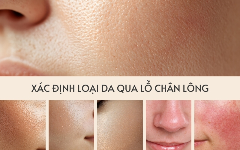 Xác định loại da qua lỗ chân lông