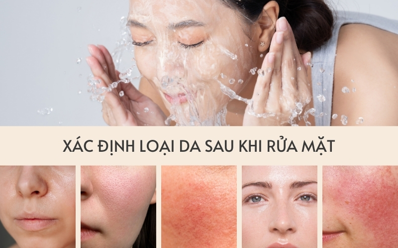 Xác định loại da sau khi rửa mặt