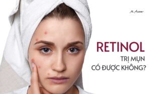 Retiol trị mụn có được không