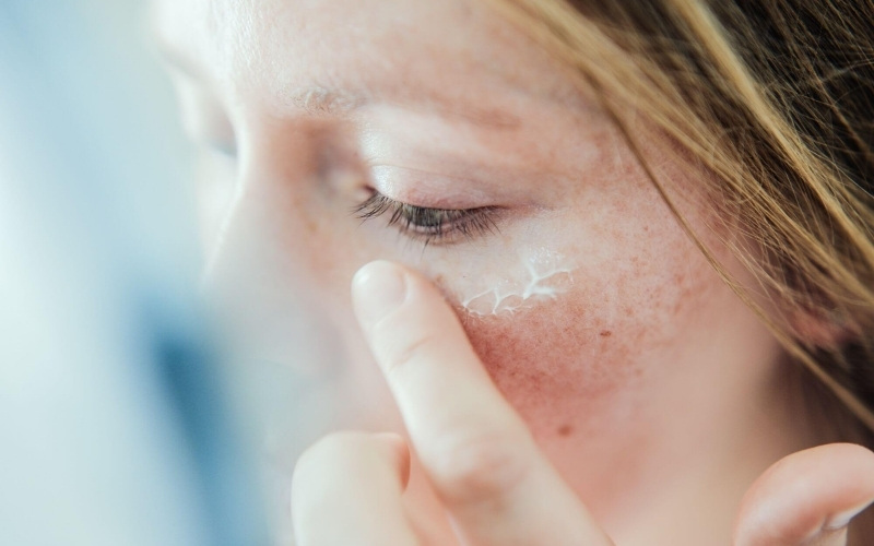 Cách phục hồi da bị kích ứng reinol