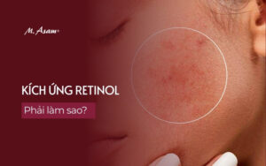 kích ứng retinol