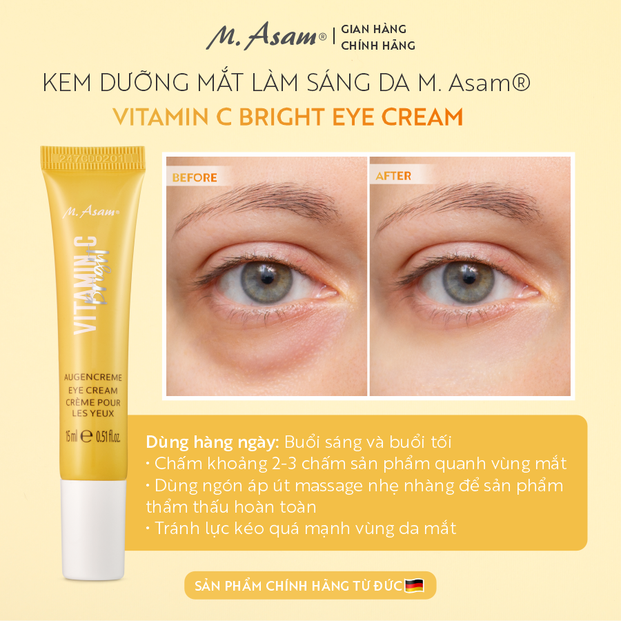 11 kem dƯỠng mẮt